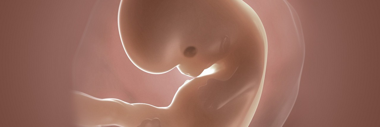 Ultraschall siebte schwangerschaftswoche Die Abkürzungen